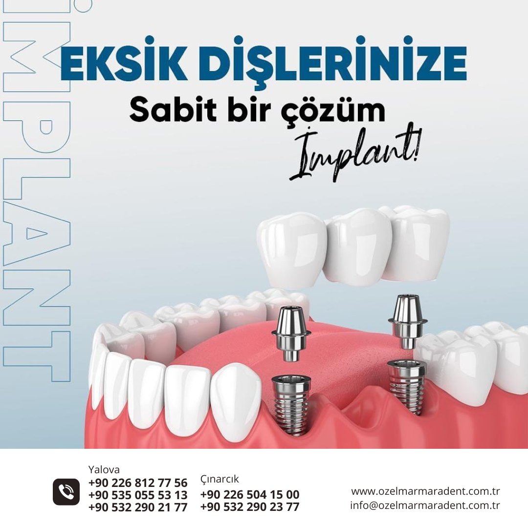 Sağlıklı dişler ve mutlu gülüşler dileriz. ozelmarmaradent.com.tr

📌Yalova Şube
☎️ +90 226 812 77 56
☎️ +90 535 055 53 13
☎️ +90 532 290 21 77

📌Çınarcık Şube
☎️ 0 226 504 15 00
☎️ 0 532 290 23 77
.
.
..
#ozelmarmaradent #dişapsesi #20likdiş #diştaşıtemizliği #zirkonyum