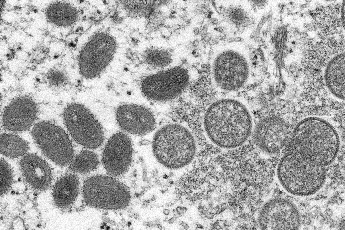 thehill's tweet photo. WHO again considers declaring monkeypox a global emergency https://t.co/nLb8LwSx4F https://t.co/Mr7lhsazMi