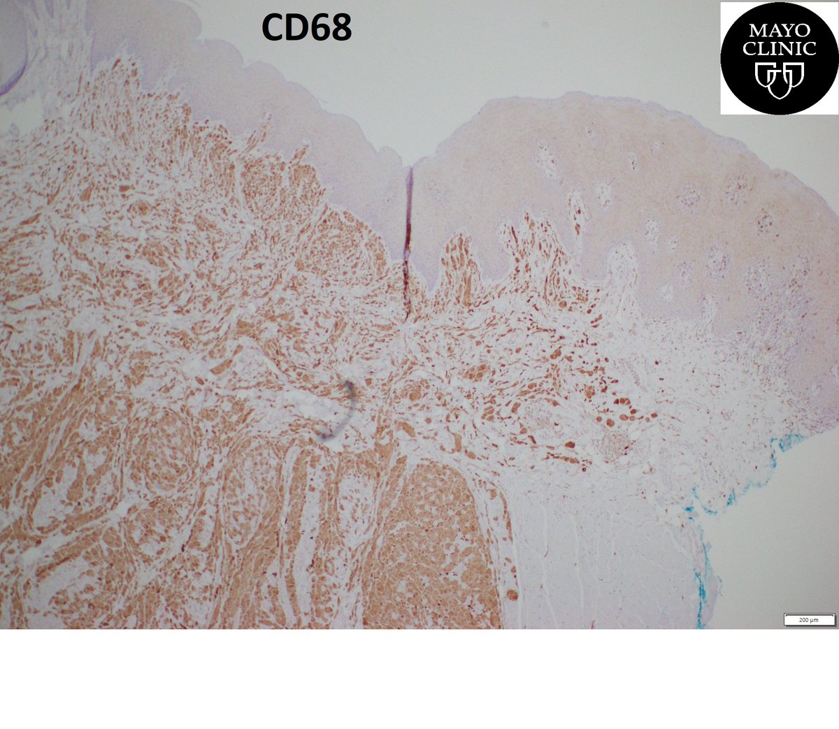 Mayo Clinic Florida Pathology tweet media