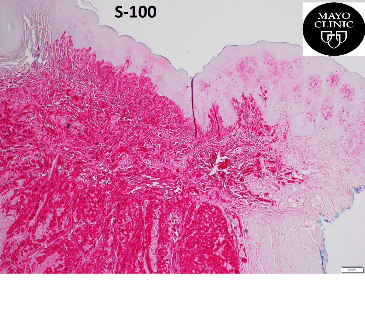 Mayo Clinic Florida Pathology tweet media