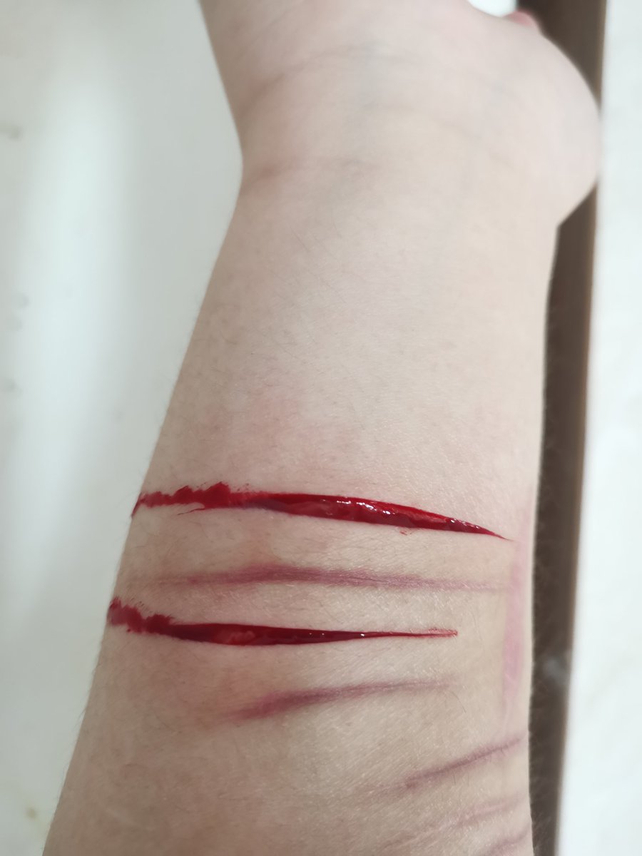 SOLITARYCORPSE's tweet photo. 7.21
右小臂。 https://t.co/EF7zWSZbB9