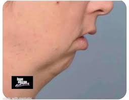 <a href="/Rothmus/">Rothmus 🏴</a> The only reason he grows a "beard".