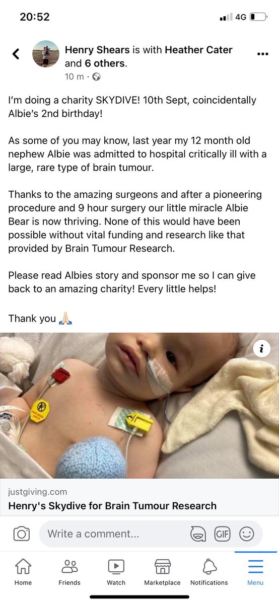 HenryShearsy1's tweet photo. Please take time to to read about why I’m doing a charity skydive for my little nephew Albie! 🙏🏻

https://t.co/dIzUSsE1yx https://t.co/6c3UnP1eWn