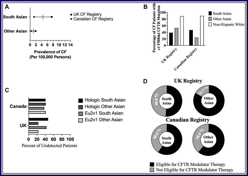 Cystic fibrosis DOES occur in Asians; the assumption that CF is extremely rare in Asians has fostered inequities in screening, diagnosis, and treatment @svaidy02 <a href="/CFmdphd/">Zachary Sellers</a> #genetics #ModulatorTherapies #NewbornScreening #CysticFibrosis gimjournal.org/article/S1098-…