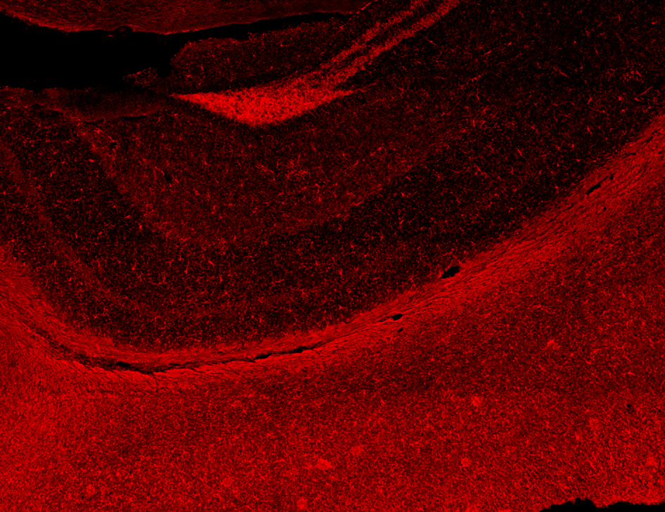 kritis45's tweet photo. Can't believe I get to do this at work!
Here are the images from my first brain imaging using confocal microscopy. 🙂
Can you tell what region of the brain this is?
Blue: Nuclei 
Red: Microglia
Magenta: Astrocytes
Green: Neuritic plaques
Go Science! https://t.co/vhm7MClCrh