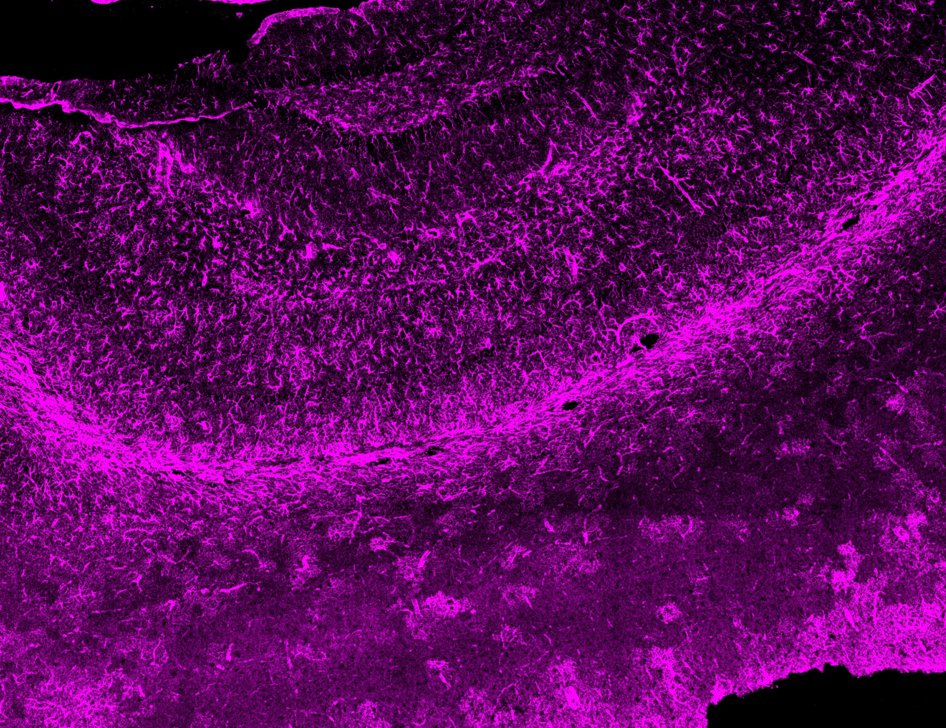 kritis45's tweet photo. Can't believe I get to do this at work!
Here are the images from my first brain imaging using confocal microscopy. 🙂
Can you tell what region of the brain this is?
Blue: Nuclei 
Red: Microglia
Magenta: Astrocytes
Green: Neuritic plaques
Go Science! https://t.co/vhm7MClCrh