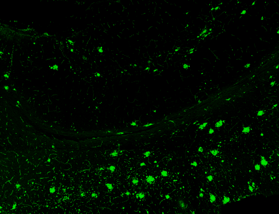 kritis45's tweet photo. Can't believe I get to do this at work!
Here are the images from my first brain imaging using confocal microscopy. 🙂
Can you tell what region of the brain this is?
Blue: Nuclei 
Red: Microglia
Magenta: Astrocytes
Green: Neuritic plaques
Go Science! https://t.co/vhm7MClCrh