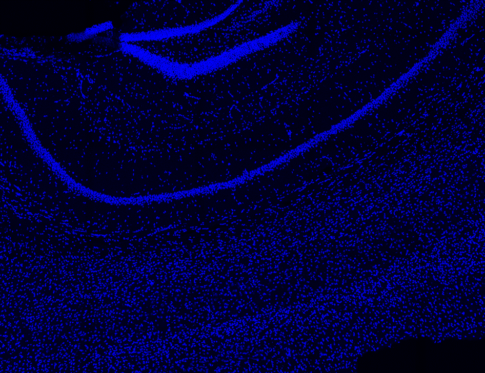 kritis45's tweet photo. Can't believe I get to do this at work!
Here are the images from my first brain imaging using confocal microscopy. 🙂
Can you tell what region of the brain this is?
Blue: Nuclei 
Red: Microglia
Magenta: Astrocytes
Green: Neuritic plaques
Go Science! https://t.co/vhm7MClCrh