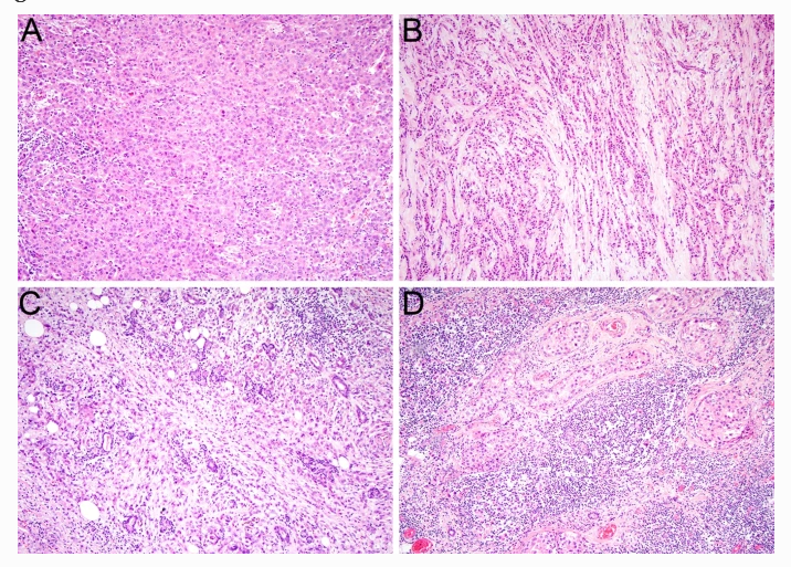 UTSW Pathology on Twitter "A recently published work lead by Dr