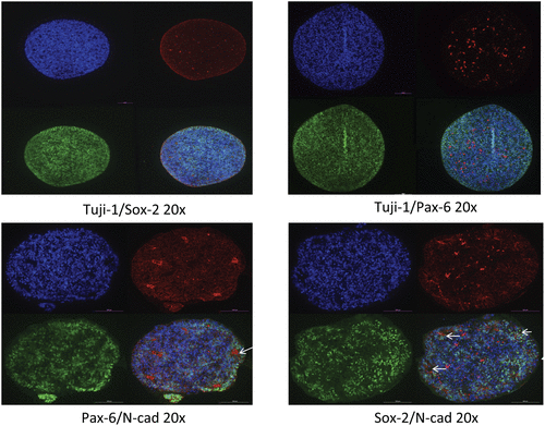 JHCnews's tweet photo. Here’s this week’s featured #ThrowbackThursday article: “The Application of the Tissue Microarray (TMA) Technology to Analyze Cerebral Organoids” by researchers from @CNRsocial_
Click to read for FREE: https://t.co/qslhwcxOqc
#pathology #cellbiology #biomarkeranalysis https://t.co/c8WIfjY9I5