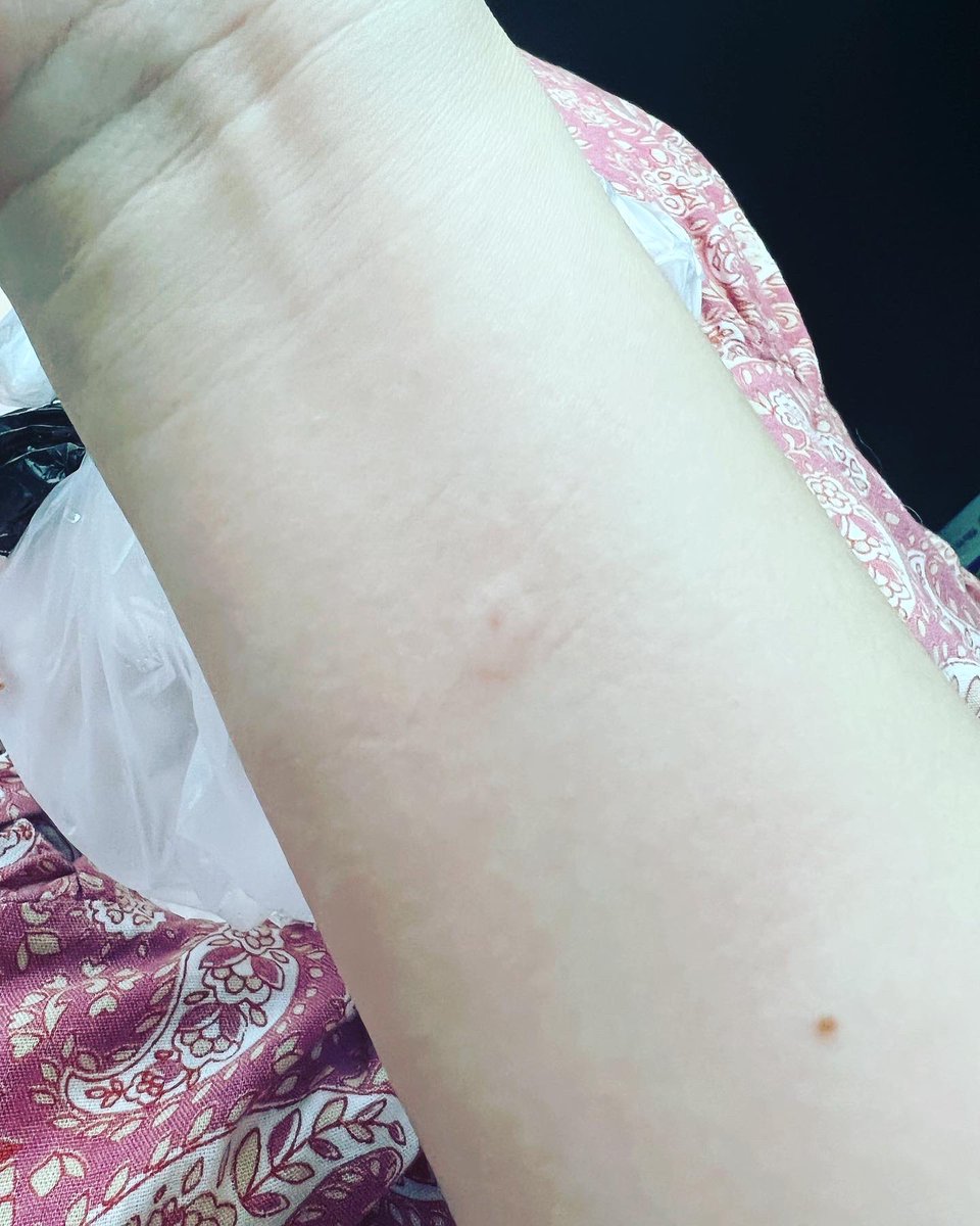 MichelleKHOU's tweet photo. Ouch!! Just got stung by a bee 🐝 for the first time ever… and it hurts like crazy! 
Fortunately, doesn’t seem like I’m allergic… I’ve got ice 🧊 on it so it’s helping… but any other remedies you might recommend?? 
.
.
.
.
@KHOU #beesting #ouch #theresafirsttimeforeverything https://t.co/jbG1gMLbIA