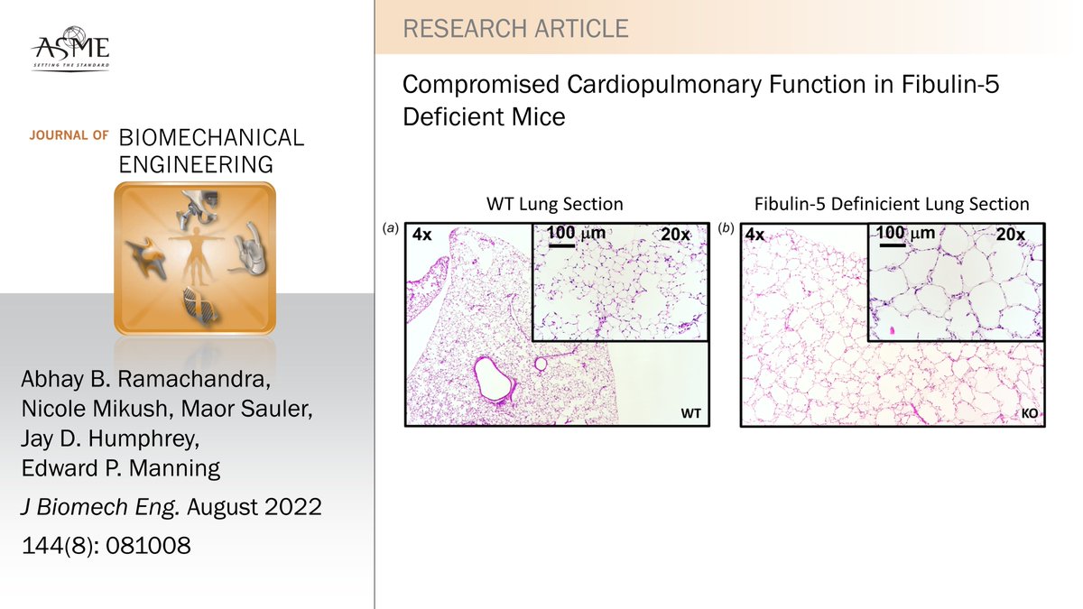 #newinJBME Investigators from @YaleBME and <a href="/YaleMed/">Yale School of Medicine</a> showed that fibulin-5 deficient mice can contribute to our understanding of the complex roles of elastin in pulmonary health and disease.