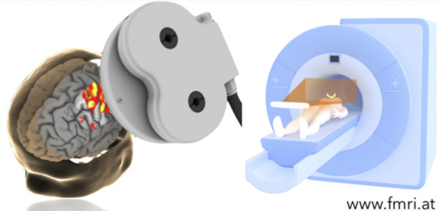 **NEW PHD POSITION on INTERLEAVED TMS/fMRI **
Come and join our team fmri.at/team/ in Vienna, Austria! The top spot to live in Europe and globally according to Mercer's Quality of Living ranking bit.ly/2O9HTGq
For more info see: fmri.at/phd/