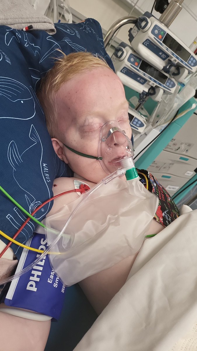 Please pray for Blake as he's in theatre, blakes bowel obstructed on Wednesday at 3am and his ileostomy stopped working so surgeons have taken him in to remove part of his bowel. He's a warrior but please send all positive vibes x