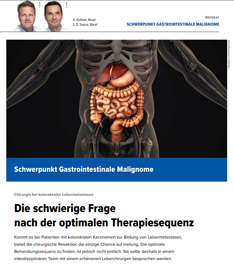 Interessante Einblicke von PD Dr. med. Savas Deniz Soysal und Prof. Dr. Otto Kollmar zum Thema Chirurgie bei kolorektalen #Lebermetastasen lnkd.in/eM6yN88t. Erschienen in Leading Opinions Hämatologie & Onkologie 4/22. #Basel #Spital #Chirurgie #kolorektal #hepatobiliär