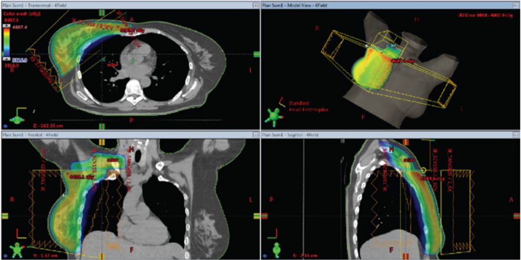 EFOMP_org's tweet photo. ✍️ EFOMP Company Member @Radformation  article in EMPNews Summer issue "Radformation Clinic in Focus - Clinical Validation of 📸EZFluence Automated Breast Planning", p.44 👇
🔗 https://t.co/BSbvSQM5EZ
#medicalphysics #Radformation #EZFluence #patient #Automated #Breast #Planning https://t.co/QgYjZ52CBr