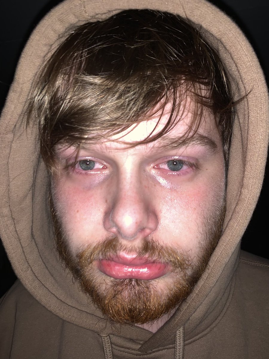 Dean tweet media