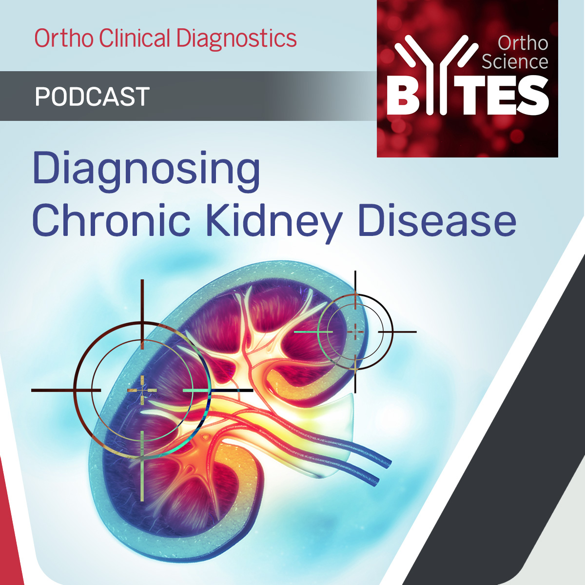 QuidelOrtho's tweet photo. Did you know that 8-10% of all adults in the world have some form of kidney damage? 

Learn more on our #OrthoScienceBytes #Podcast. 

https://t.co/VAbWPIPVSf 

#OrthoClinicalDiagnostics #BecauseEveryTestIsALife #CKD https://t.co/hoKoHSZfZw