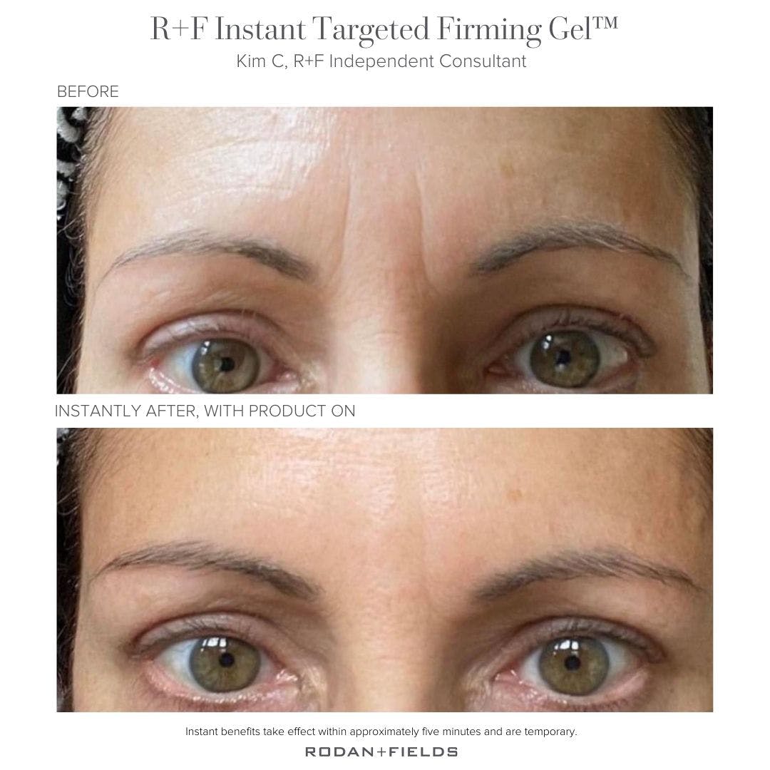 Do you love to see transformation photos? I do! 🙋🏼‍♀️ Love all the fabulous results that keep pouring in from happy peeps who are using  R+F Instant Targeted Firming Gel. ❤️ DM me if you are a wee bit curious. 😊