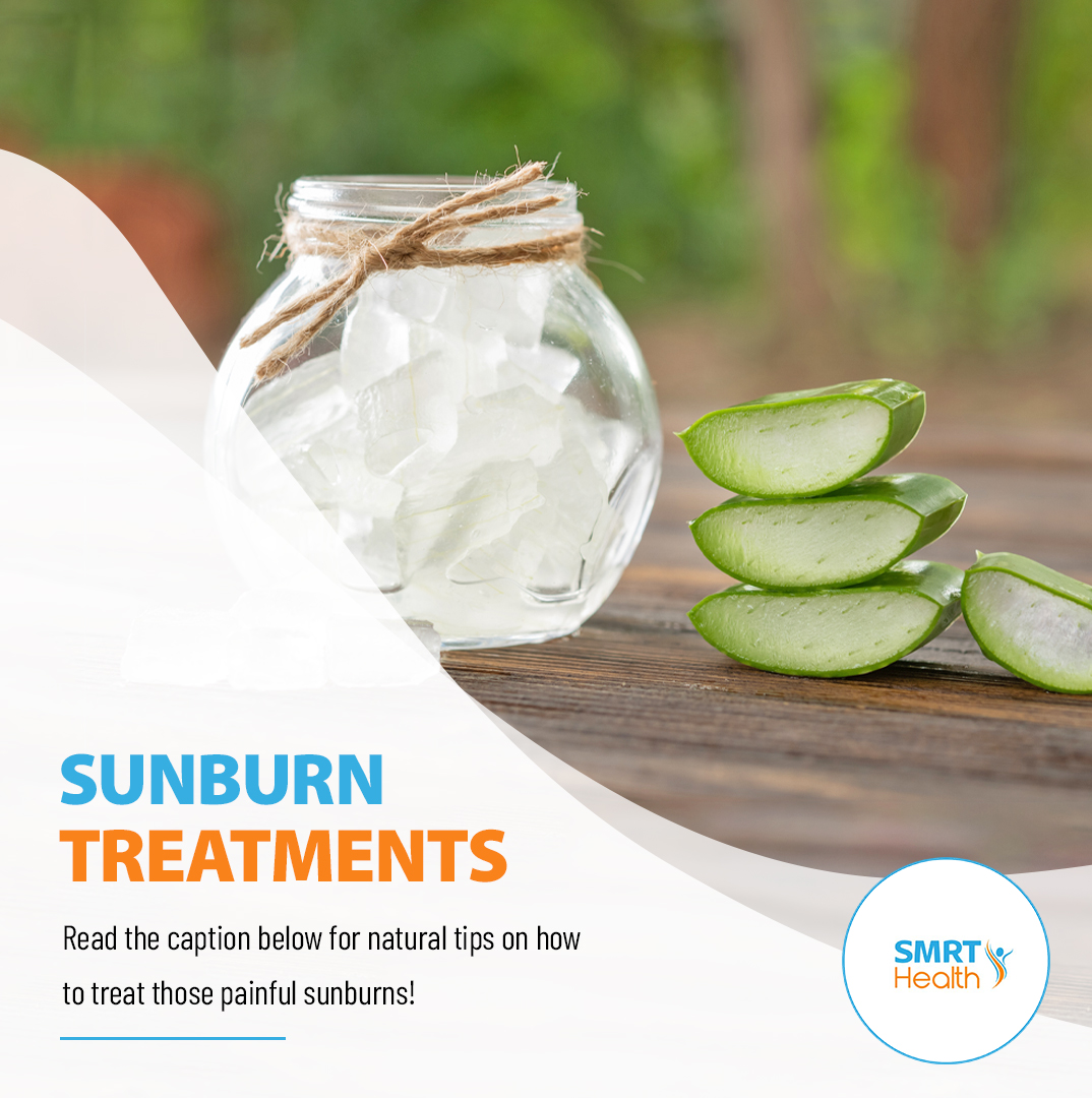 SMRT_Health's tweet photo. We all know how frustrating it is to deal with a sunburn after a long summer day; here are 2 natural tips for treating a burn:

1. Freeze Aloe Gel.
2. Use Coconut Oil.

Both of these help to moisturize your skin while also soothing the burn. https://t.co/irgalZeIck