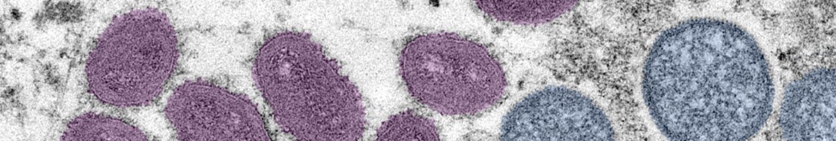 MaineAFP's tweet image. Monkeypox now REPORTABLE condition in Maine-  newsmanager.commpartners.com/mainemed/issue…