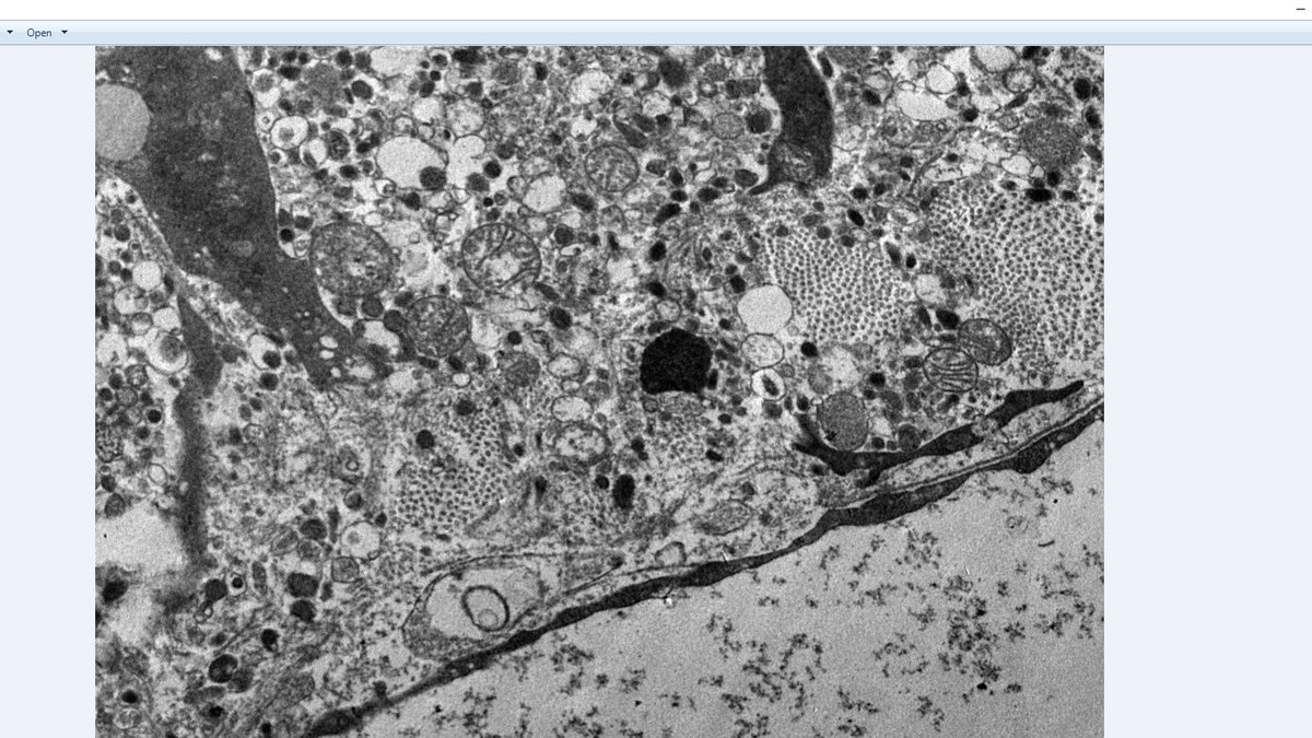 Boom! our 1st EM pictures from primary chromaffin cells :) captured at <a href="/unescorcb/">RCB</a>. Cells are Jam-packed with organelles dense core, potentially synaptic vesicles. Wondering it's a splanchnic nerve--chromaffin cell synapse? Thanks for hard work <a href="/MukherjeeCm_02/">Chandramouli Mukherjee</a> and <a href="/VINAYAK46009394/">Vinayak Ghosh</a>