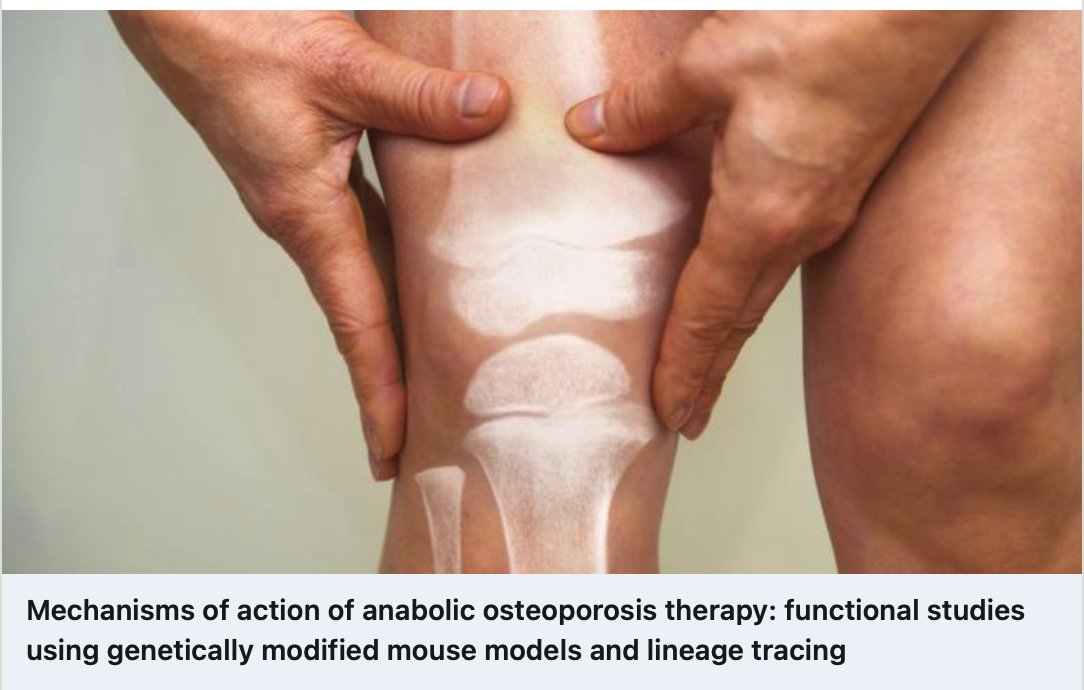 Christa Maes (@scebp_lab) on Twitter photo You can still apply for this amazing #international joint #PhD opportunity <a href="/KU_Leuven/">KU Leuven</a> and <a href="/unimelb/">University of Melbourne</a> in #bone #biology & #osteoporosis #therapy #research 🦴🔬🎓 with <a href="/SCEBP_Lab/">Christa Maes</a> 🇧🇪🌍 and <a href="/NatalieASims/">Prof Natalie A Sims</a> @nataliekywee 🇦🇺🌏
Apply by August 1st, 2022 👇👇👇
kuleuven.be/personeel/jobs… You can still apply for this amazing #international joint #PhD opportunity <a href="/KU_Leuven/">KU Leuven</a> and <a href="/unimelb/">University of Melbourne</a> in #bone #biology & #osteoporosis #therapy #research 🦴🔬🎓 with <a href="/SCEBP_Lab/">Christa Maes</a> 🇧🇪🌍 and <a href="/NatalieASims/">Prof Natalie A Sims</a> @nataliekywee 🇦🇺🌏
Apply by August 1st, 2022 👇👇👇
kuleuven.be/personeel/jobs…