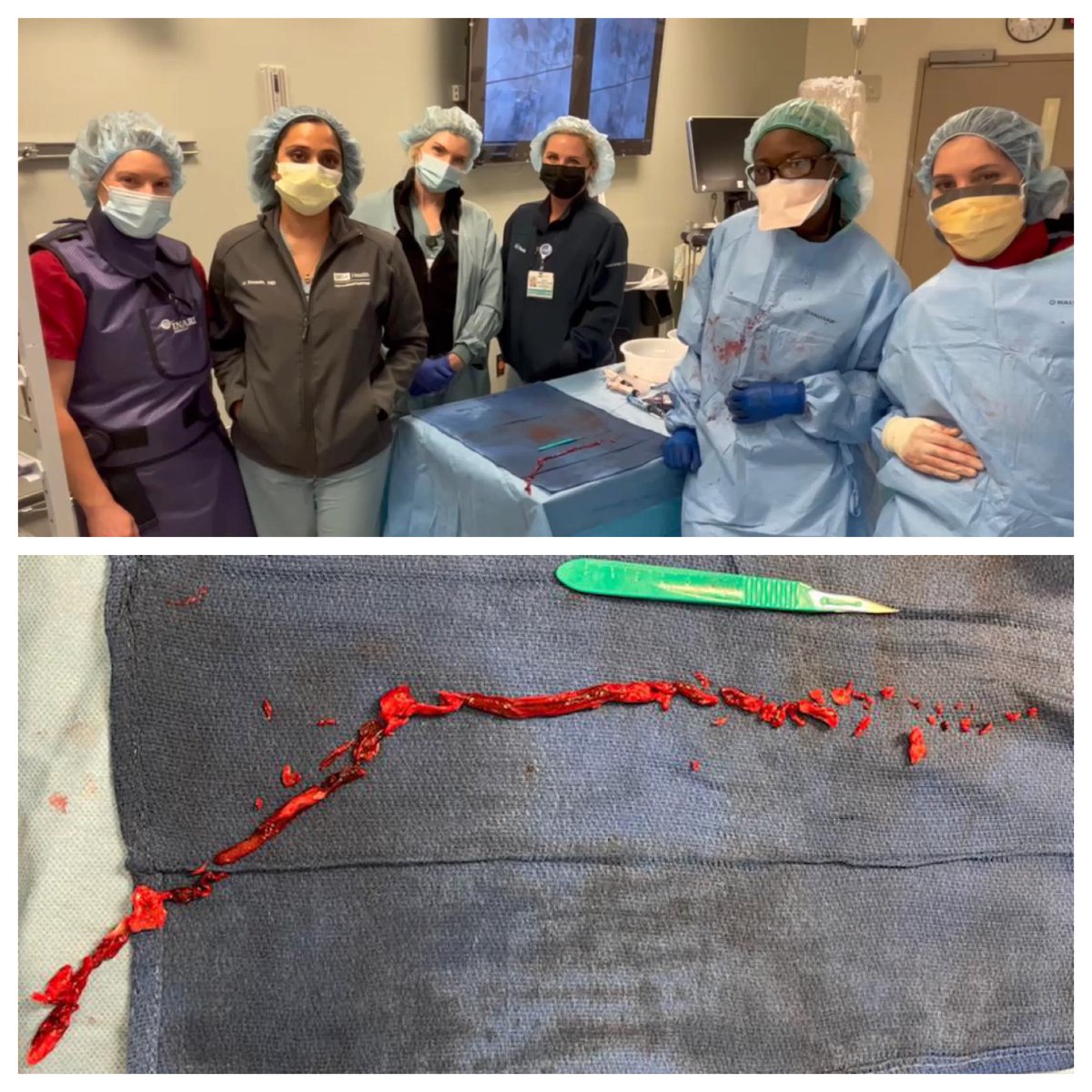 Margerie Arraut (@margeriearraut) on Twitter photo All girl crew in IR!!! Honored to be part of such an amazing and diverse group of women in IR! Successful iliocaval thrombectomy with Inari FlowTriever <a href="/womenirads/">WomeninIR</a> <a href="/msran124/">Mona Ranade</a> <a href="/RadiologyUcla/">UCLA Radiology</a> <a href="/uclaVIR/">UCLA IR</a> <a href="/SGilyardMD/">Shenise Gilyard, MD</a> <a href="/InariMedical/">Inari, now part of Stryker</a> #womeninIR All girl crew in IR!!! Honored to be part of such an amazing and diverse group of women in IR! Successful iliocaval thrombectomy with Inari FlowTriever <a href="/womenirads/">WomeninIR</a> <a href="/msran124/">Mona Ranade</a> <a href="/RadiologyUcla/">UCLA Radiology</a> <a href="/uclaVIR/">UCLA IR</a> <a href="/SGilyardMD/">Shenise Gilyard, MD</a> <a href="/InariMedical/">Inari, now part of Stryker</a> #womeninIR