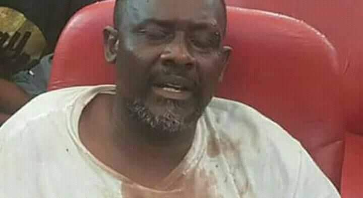 MeyaJadis2's tweet photo. A sa sortie de la prison,Franck Diongo ne cessait de traiter en mal le PR élu Martin Fayulu d'un haineux et de la mauvaise,faisant l'opposition radicale au fils de Wa Mulumba.Aujd8 je pense que Diongo souffre d'une grave maladie de l haine,en se lançant à l'opp contre TSHILOMBO. https://t.co/MLHHZm0ClN