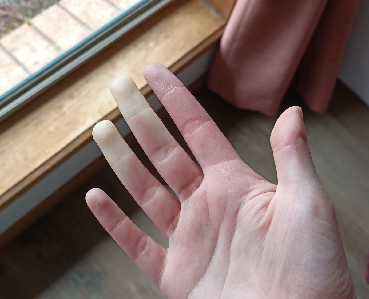 KayCritchell's tweet image. A fun lil game me and my body play in winter
Me: ok body, we are going to hang out laundry Full disclosure: it's mildly chilly
Body: cool we can do that... You can't have functioning finger tips after though, I don't make the rules

It's 9 degrees #notEvenThatCold