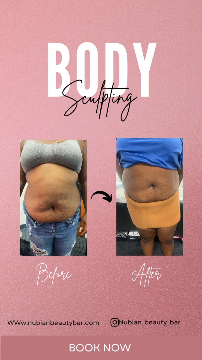 nubianbeautybar's tweet photo. Fat dissolve shots book your appointment now!
#fatdissolve
#orlandobodycontouring
#BlackOwnedBusiness https://t.co/XDambqhRbg