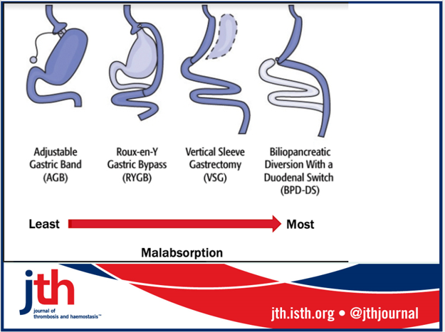 JTHjournal's tweet photo. Do DOACs have preserved safety/efficacy after bariatric sx? In #JTHiC article, we systematically review data &amp; propose management algorithm incorporating measurement peak drug levels.  @SMithoowani @crowthrm @dkchu @MacDeptMed @machealthsci @STJOESHAMILTON https://t.co/BwpnXTQbSC https://t.co/wmAC3F2XxI
