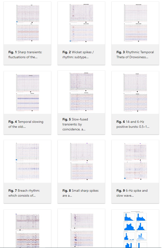Sandor Beniczky tweet media