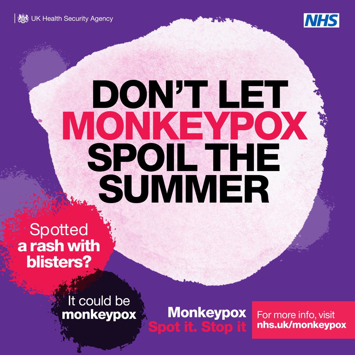 Anyone can get monkeypox. If you have a new rash, body aches, a fever, or other symptoms of monkeypox, avoid close physical contact with others and visit nhs.uk/monkeypox for more advice.