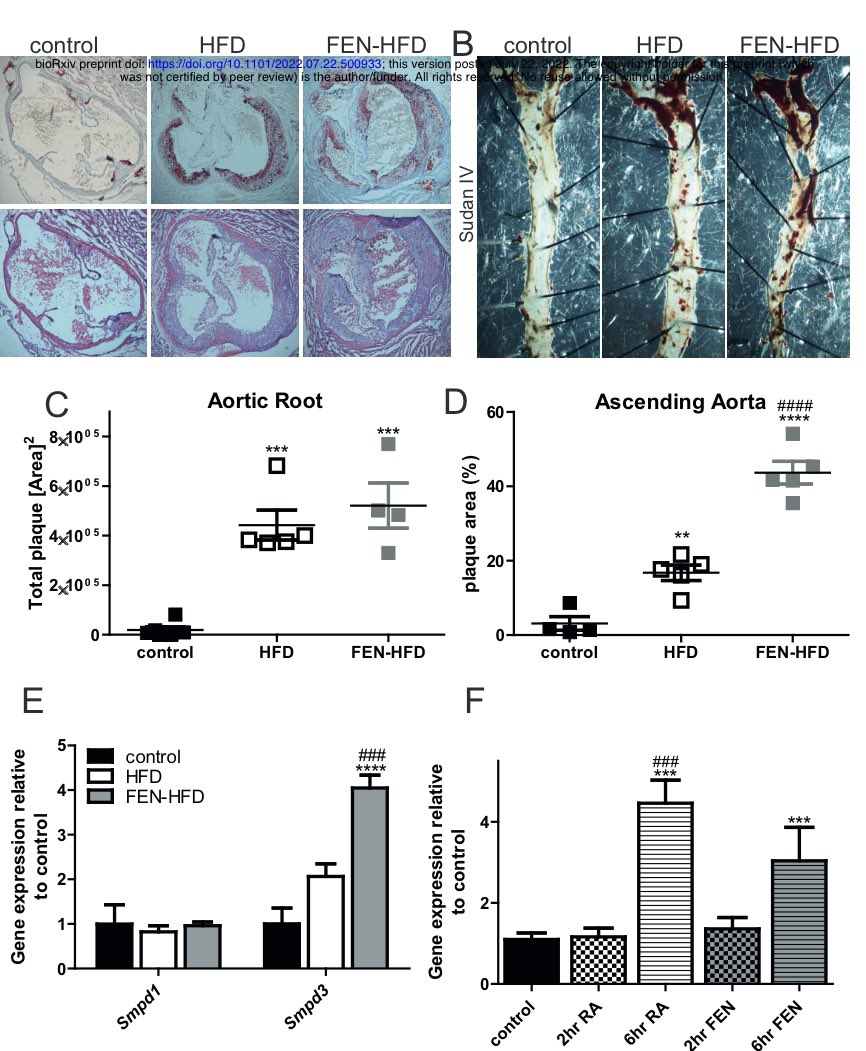 The Yin Yang and metabolic dark side of the synthetic retinoid Fenretinide in mice biorxiv.org/content/10.110…