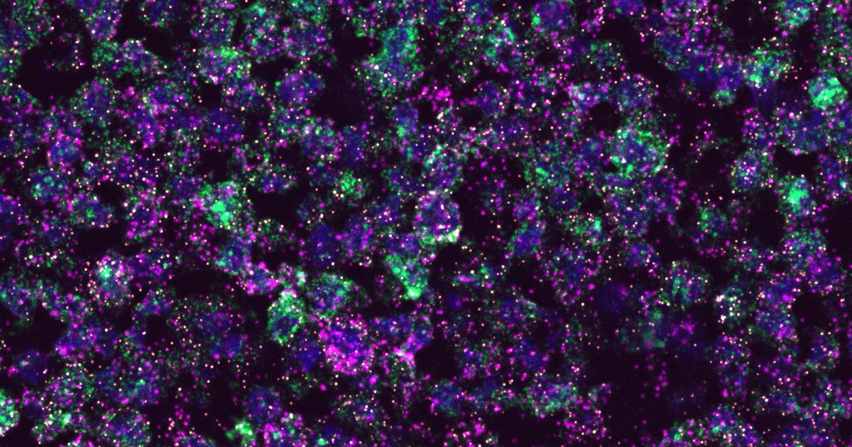tycheleturner's tweet image. First image from @TNTurnerLab during #RNAscope training. Slightly lower resolution due Twitter upload. Imaging @wuccilab on new #confocal from @NIMHgov instrument grant to @JFitzpatrickWU. Colleague stated full image looked like from @NASAWebb.😊  #noncoding #collaboration