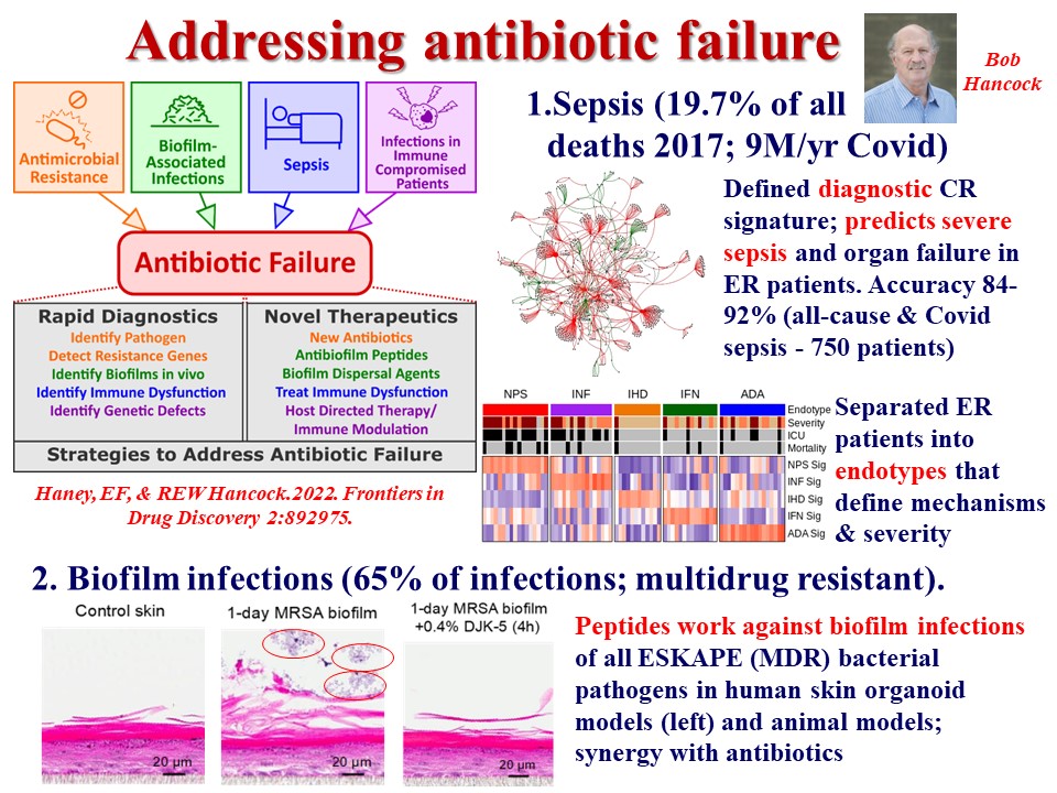 In September NGDI UBC will be highlighting the research of its investigators. As a preview check out the outstanding Sepsis/Antibiotic research from NGDI Co-Founder Dr. Bob Hancock <a href="/thehancocklab/">Hancock Lab UBC @thehancocklab@mstdn.science</a> <a href="/SepsisAlliance/">Sepsis Alliance</a> <a href="/SepsisCanada/">Sepsis Canada</a> <a href="/DNDi/">Drugs for Neglected Diseases initiative</a> <a href="/UBCMicroImmuno/">UBC Dept of Microbiology and Immunology</a> <a href="/Can_NTDs/">Canadian Network for Neglected Tropical Diseases</a> <a href="/ISNTD_Press/">ISNTD</a> <a href="/CUGHnews/">CUGH</a>