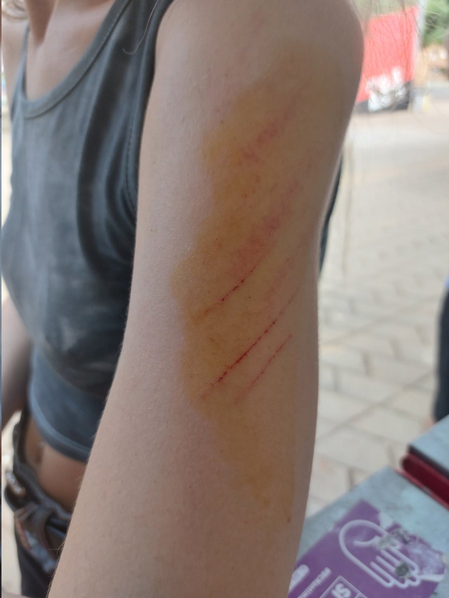Agressions anticastristes i espanyolistes aquest migdia a l'acte del "Sempre és 26" del <a href="/CP3VoltesRebel/">CP 3 Voltes Rebel</a> . 

Les persones agredides estan presentant denúncies per agressions i pet delicte d'odi polític i transfòbic.