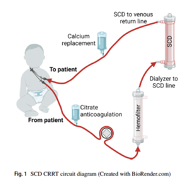 chungk1031's tweet photo. Selective Cytopheretic Device (#SCD) at work. 👇

@IPNA_PedNeph 
@SeaStarMedical 

Use of extracorporeal immunomodulation in a toddler with hemophagocytic lymphohistiocytosis and multisystem organ failure
https://t.co/wszExJmOwB https://t.co/jd6jebp4zb