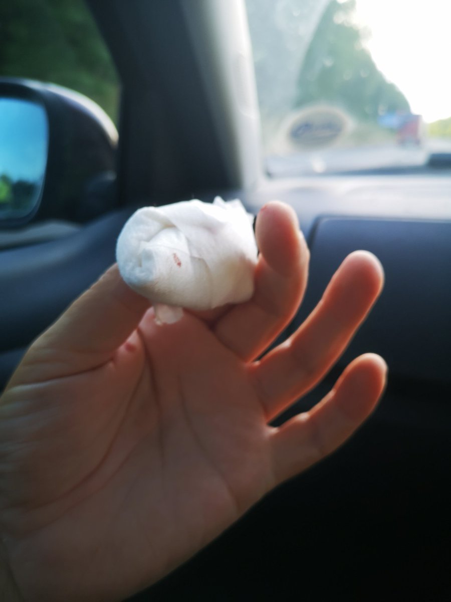 euphogeeza's tweet photo. Sliced end of finger off. Straight through the nail to the tip. Off to hostipal. https://t.co/7J08iqyy0E
