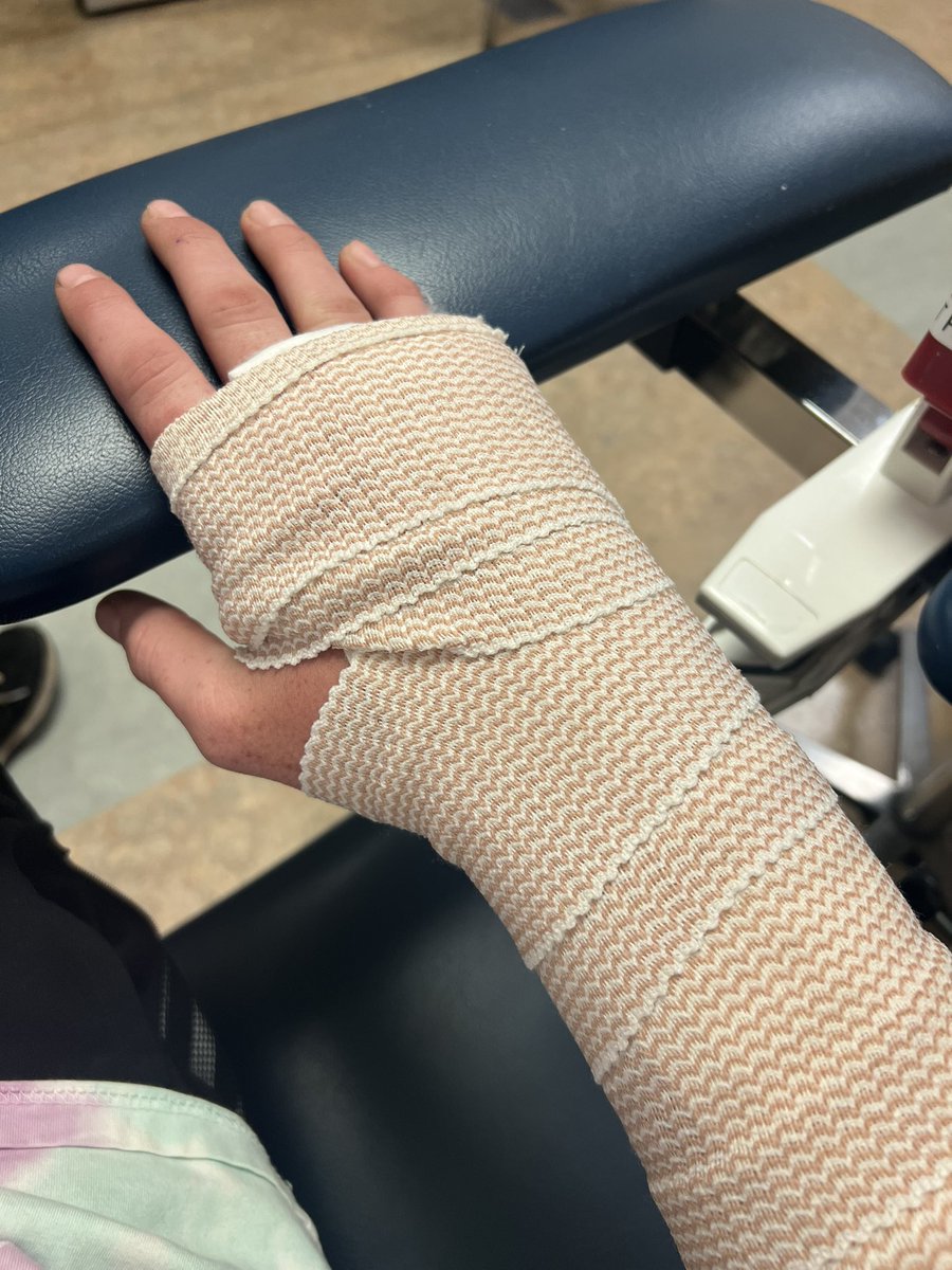 Tanner_Not_Tan's tweet photo. Unfortunately managed to smack my hand real good on a boulder. Broke the metacarpal in my right ring finger. OUCH! Despite the set back, still some of the best days of my life. https://t.co/MFWVyc1BbT