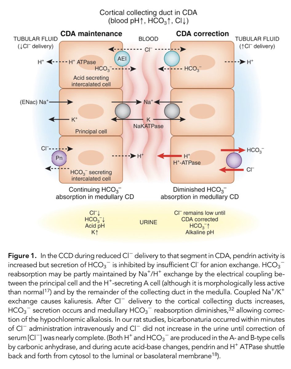 edgarvlermamd's tweet photo. Chloride depletion alkalosis ca. 2012 from @JASN_News #Nephpearls

👉🏼 https://t.co/KSPpk1rZSh https://t.co/mm07Cp5un8