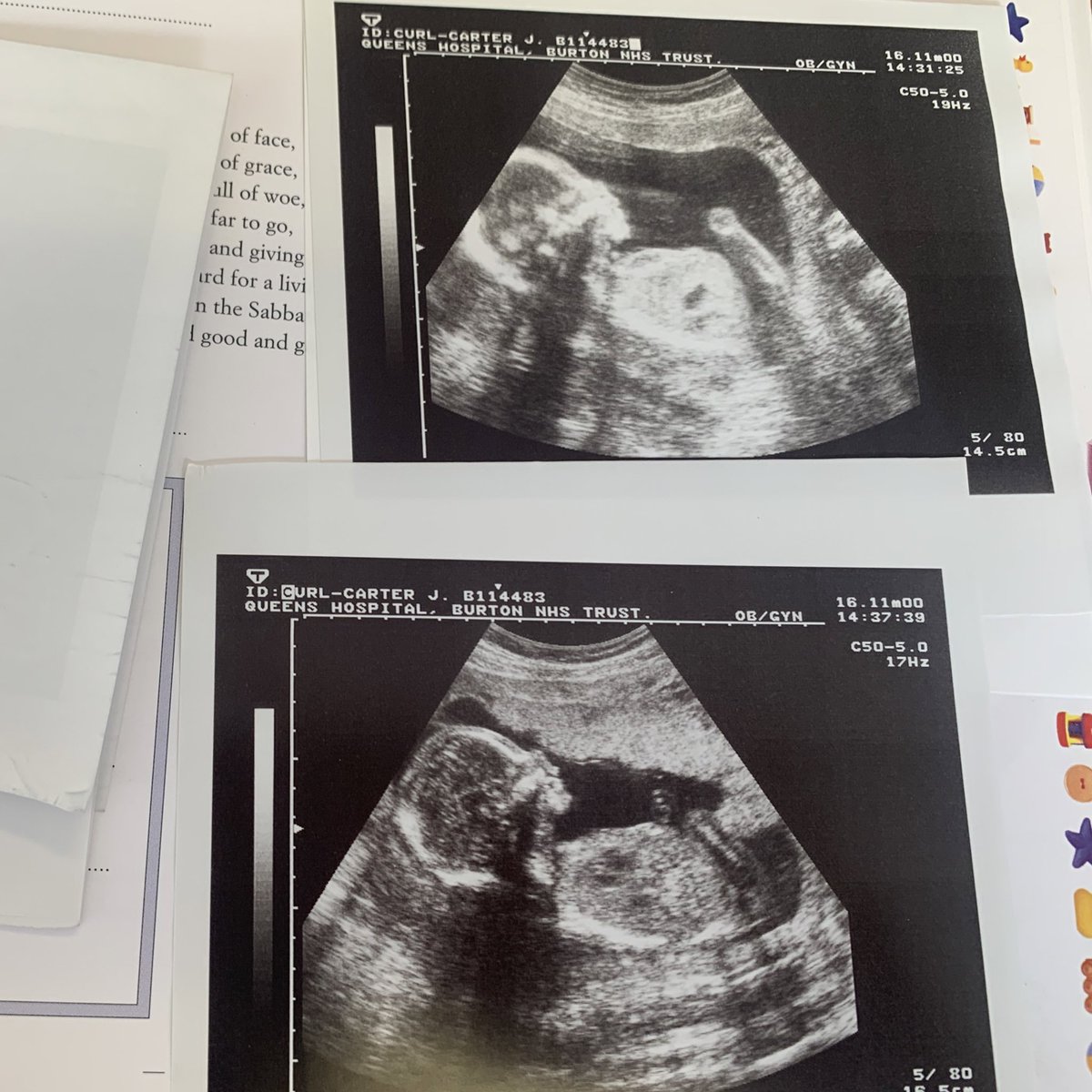 Catherine Mellor (@catherinemell0r) on Twitter photo Bit of a shot in the dark sharing on here…
Baby scan photos from Burton Hospital found in journal book in Hatton lighthouse charity shop - not sure how recent they are, would hate for someone to be missing them.
Have handed to the staff behind the till. <a href="/UHDBTrust/">University Hospitals of Derby and Burton NHS FT</a> Bit of a shot in the dark sharing on here…
Baby scan photos from Burton Hospital found in journal book in Hatton lighthouse charity shop - not sure how recent they are, would hate for someone to be missing them.
Have handed to the staff behind the till. <a href="/UHDBTrust/">University Hospitals of Derby and Burton NHS FT</a>