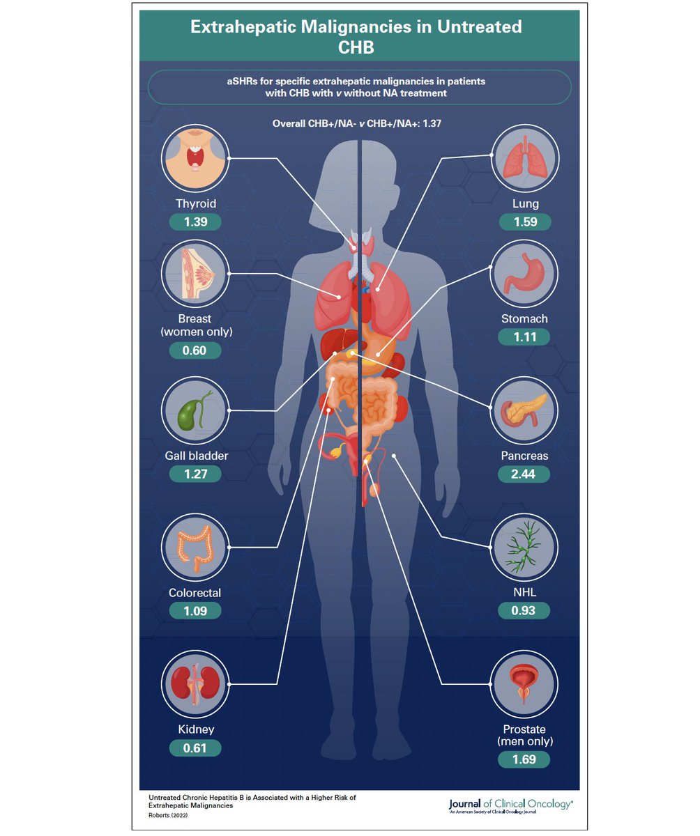 ArndtVogel's tweet image. 🔥Interesting study on the risk of extrahepatic cancer in #HBV infection! @JCO_ASCO 
doi.org/10.1200/JCO.21…

✅30,413 pts -&amp;gt; 3.9% cancers
👉NA treatment: 28% risk⬇️

but risk for #RCC &amp;amp; BC⬆️
and risk for #HCC and #Cholangiocarcinoma not ⬇️

👉be aware!

@EASLedu #livertwitter