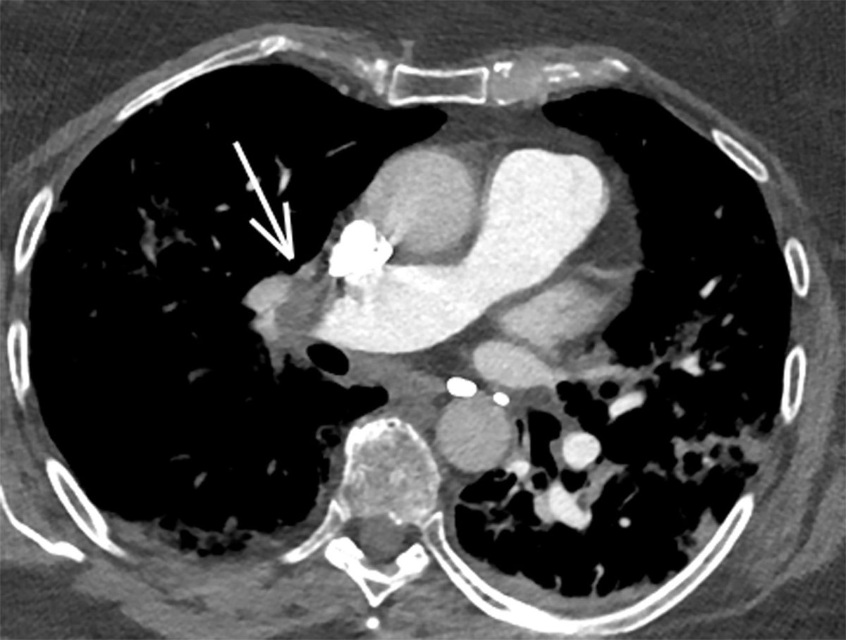 AppliedRadiology tweet media