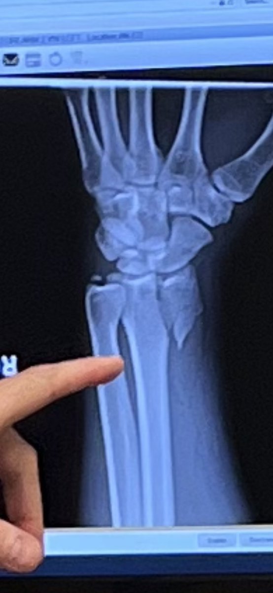 MarcoAndretti's tweet image. Sub ideal.  Saw stars the last  few laps up on the cushion.