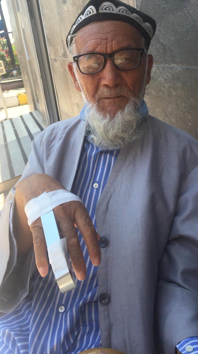 Eyüp Sultan'da yaşanan 80 yaşındaki Doğu Türkistanlı bir soykırım mağduru dede, derdini cami cemaatine anlatmak için yakınlarının resimlerini içeren bir afiş açmak isterken kolluk kuvvetler tarafından #Uygurdede #Mahmuttohti ‘nın parmağının da kırıldığı öğrenildi.