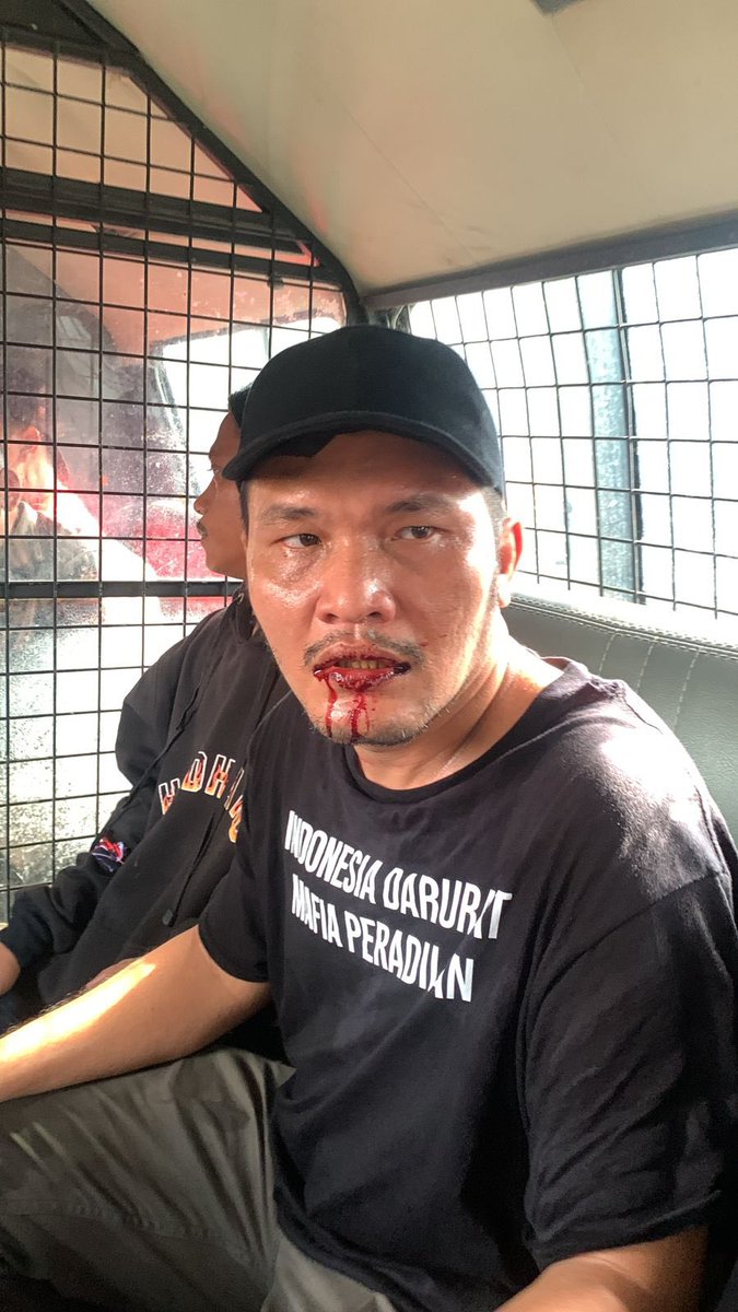Ndheso_'s tweet photo. @NichoSilalah1 Udah pasang Yg bari sih 😁🤣😁🤣🤣 https://t.co/U1CeiQzild