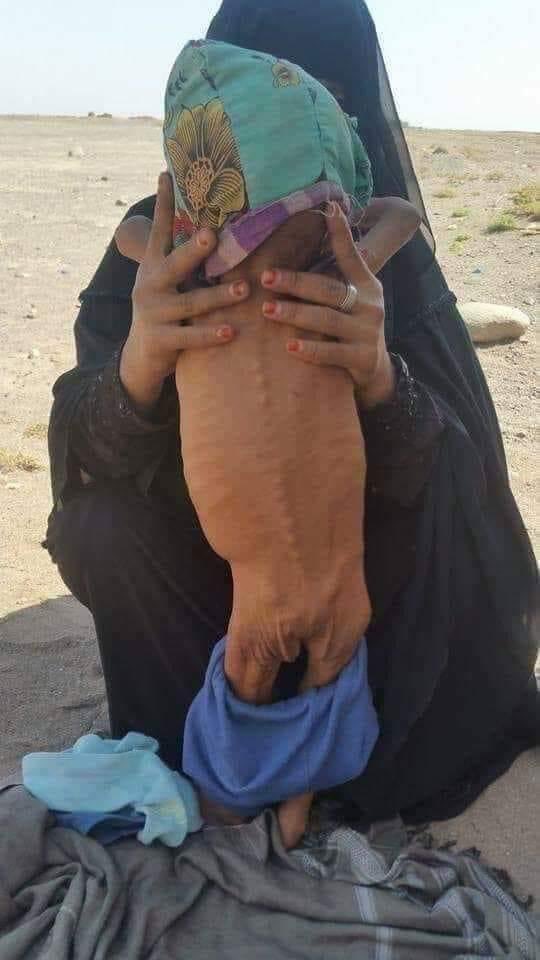 Basmallah87's tweet image. No one writes about the war or hunger in Yemen...

The whole world can help Ukraine, but Yemen, nothing, not a peep in the MSM. We have money for weapons, not for food! 
But we have you who will not let us down like the world do.
Support &amp;amp;donate at
gogetfunding.com/emergency-appe…