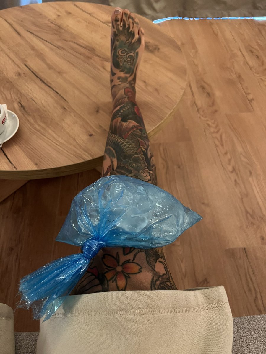 Dafina_Zeqiri's tweet photo. Achhh ❤️‍🩹
Kanihere do levizje qe du mi bo, po duhet me i “mendu” gjat performances “a me bo? A mos me bo? Qka i kisha bo!” Ishalla me “kfiellet” kjo kembeee najhere…  #postACLsurgery https://t.co/DrqGQ94GUv